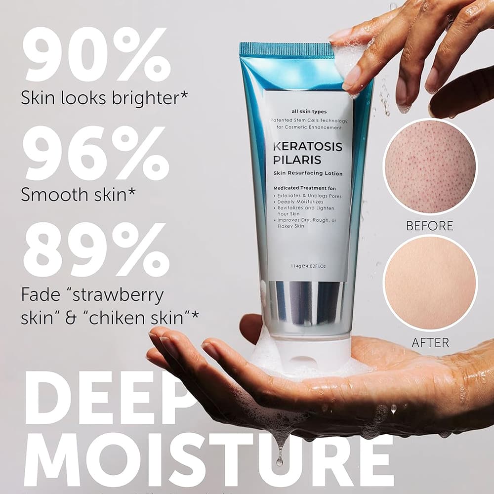 HealingKP Cream Display