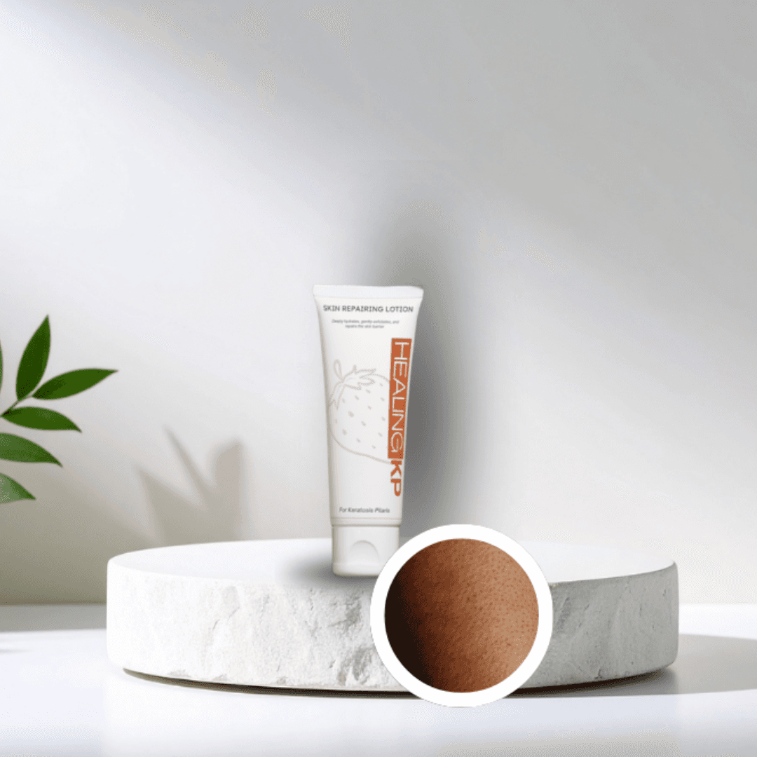 HealingKP Relief Cream